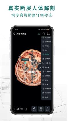 3DѰͼ2
