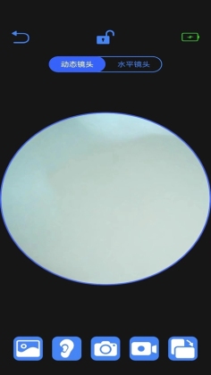 AiSee Pro安卓版可视挖耳勺截图1