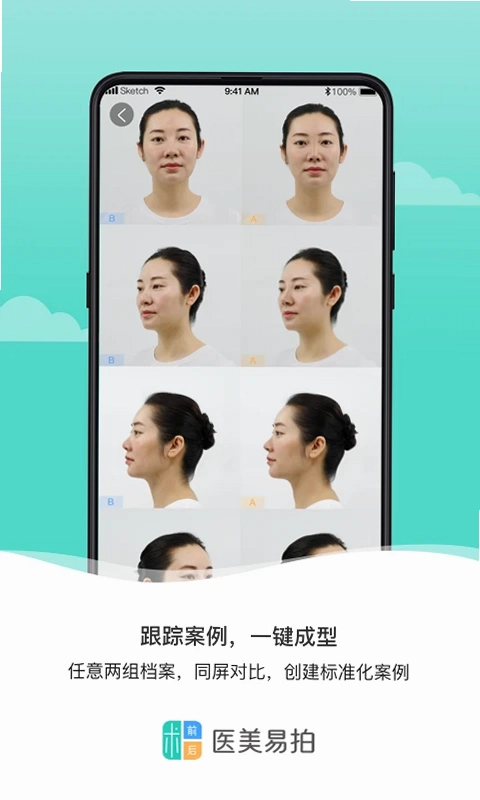 医美易拍最新版预览图