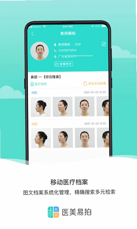 医美易拍最新版预览图