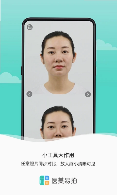 医美易拍最新版预览图