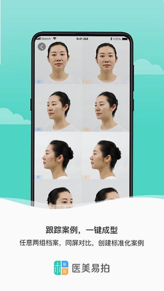 医美易拍最新版预览图
