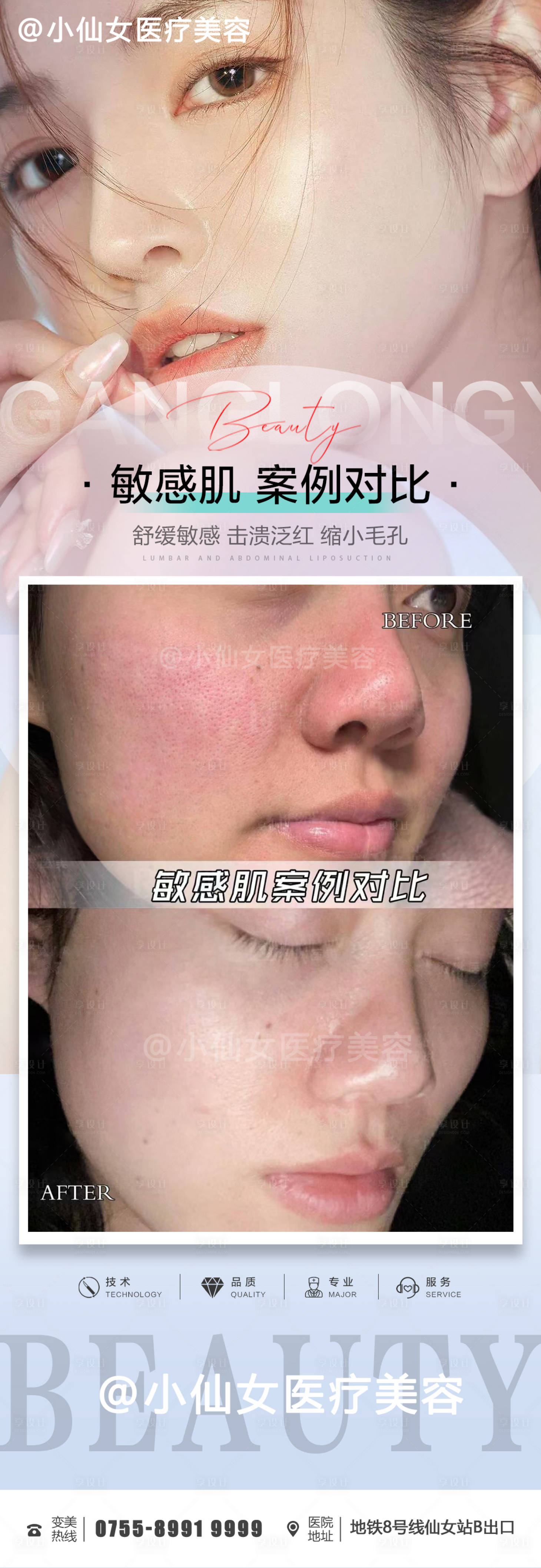 呵护总监敏感肌护理排行榜实测对比图