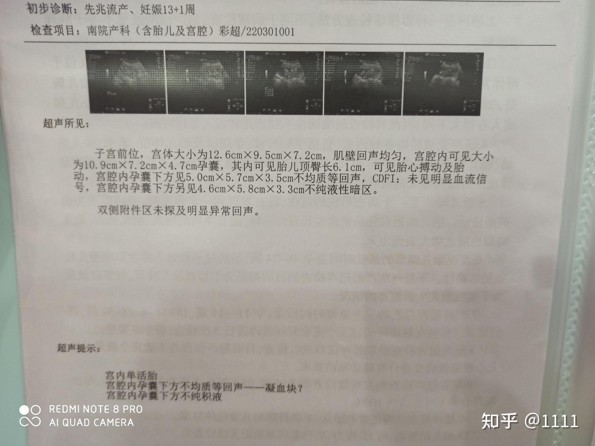 孕育册产检记录页实拍