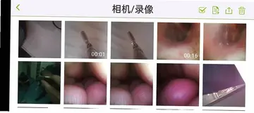 JTsee(杰泰内窥镜)预览图