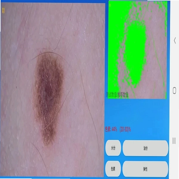 MRKV头皮毛发检测仪预览图