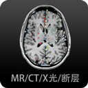 Ӱ�����ͼ���ֻ���