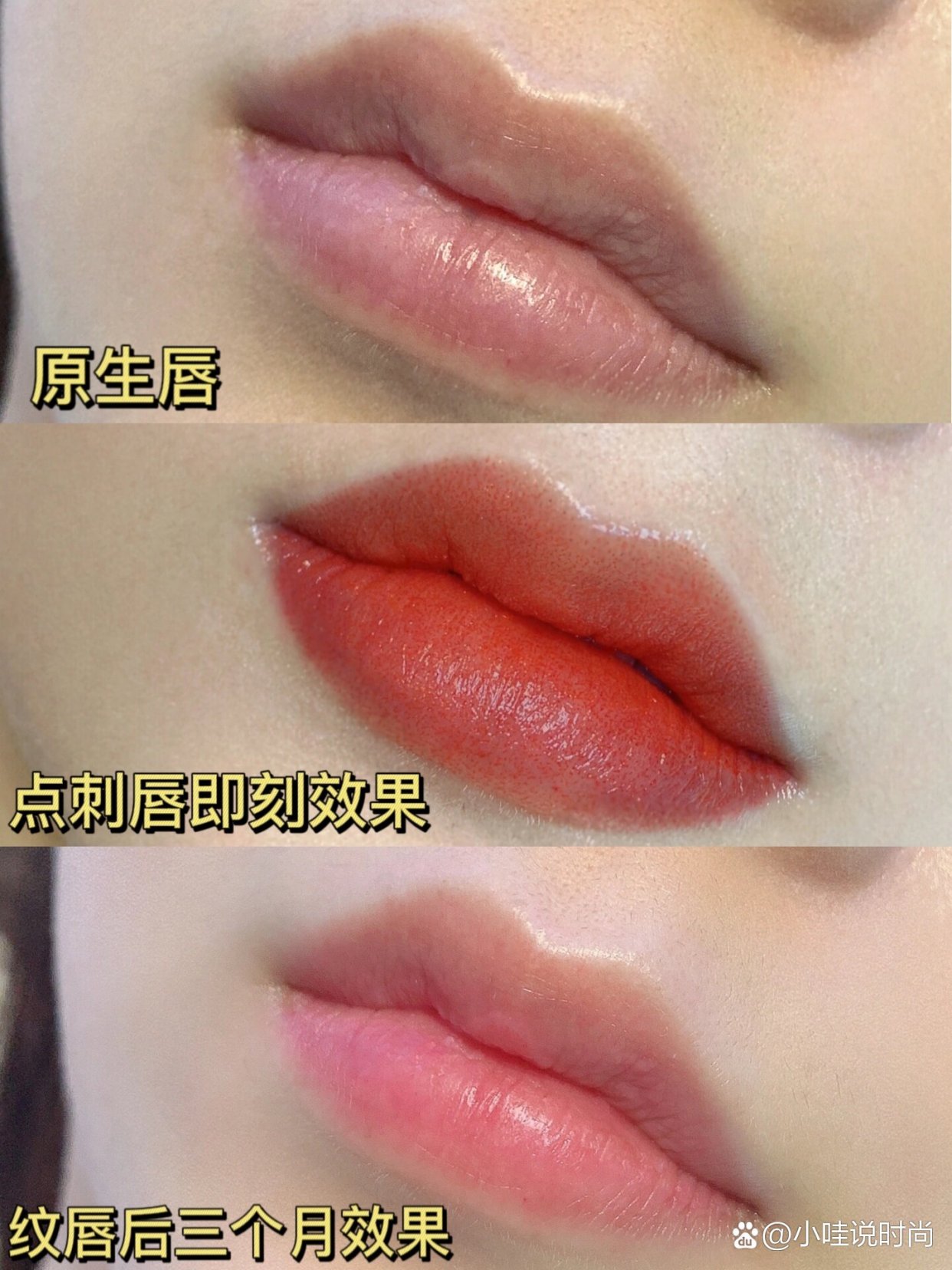 露美纹唇恢复后自然唇色效果实拍