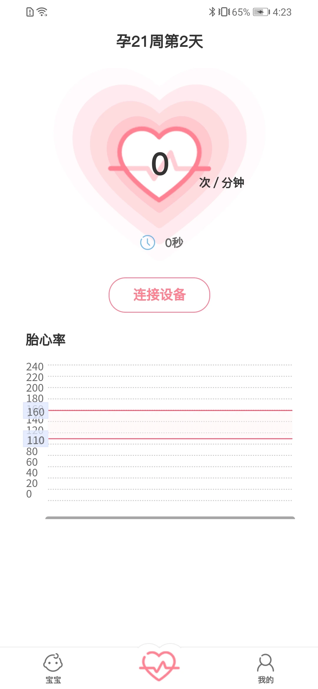 fetalheart胎心仪胎心监护