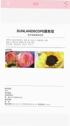 SunlandScopeԤ��ͼ