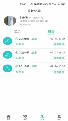 胎心监护预览图