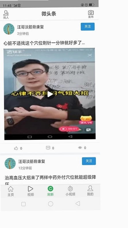 ΢ͷ��Ԥ��ͼ