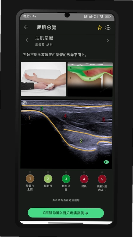 超声智学预览图