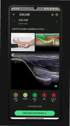 超声智学预览图