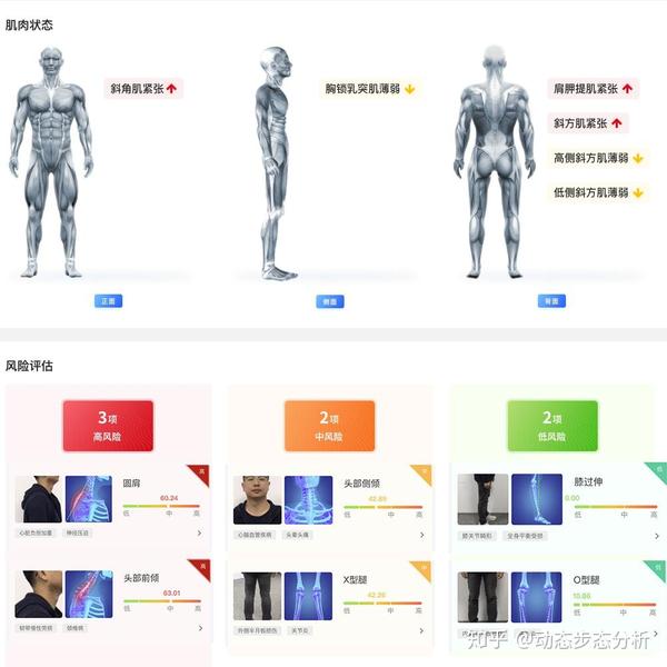 体态大师效果怎么样真实反馈对比