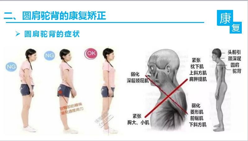 体态大师改善圆肩驼背日常习惯调整