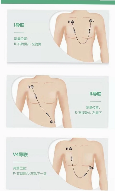 RN ECG(动态心电记录仪)预览图
