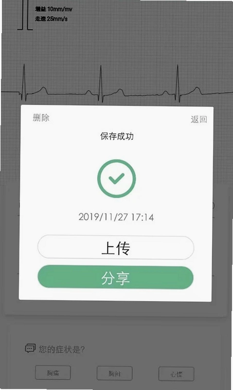 RN ECG(动态心电记录仪)预览图