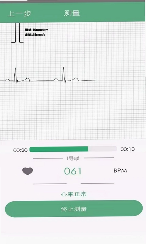 RN ECG(动态心电记录仪)预览图